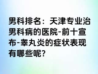 男科排名：天津专业治男科病的医院-前十宣布-睾丸炎的症状表现有哪些呢？