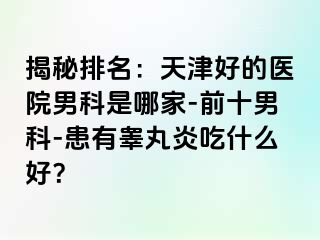 揭秘排名：天津好的医院男科是哪家-前十男科-患有睾丸炎吃什么好？