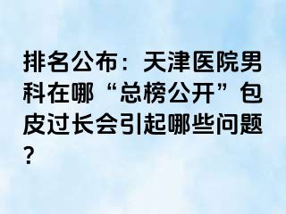 排名公布：天津医院男科在哪“总榜公开”包皮过长会引起哪些问题？